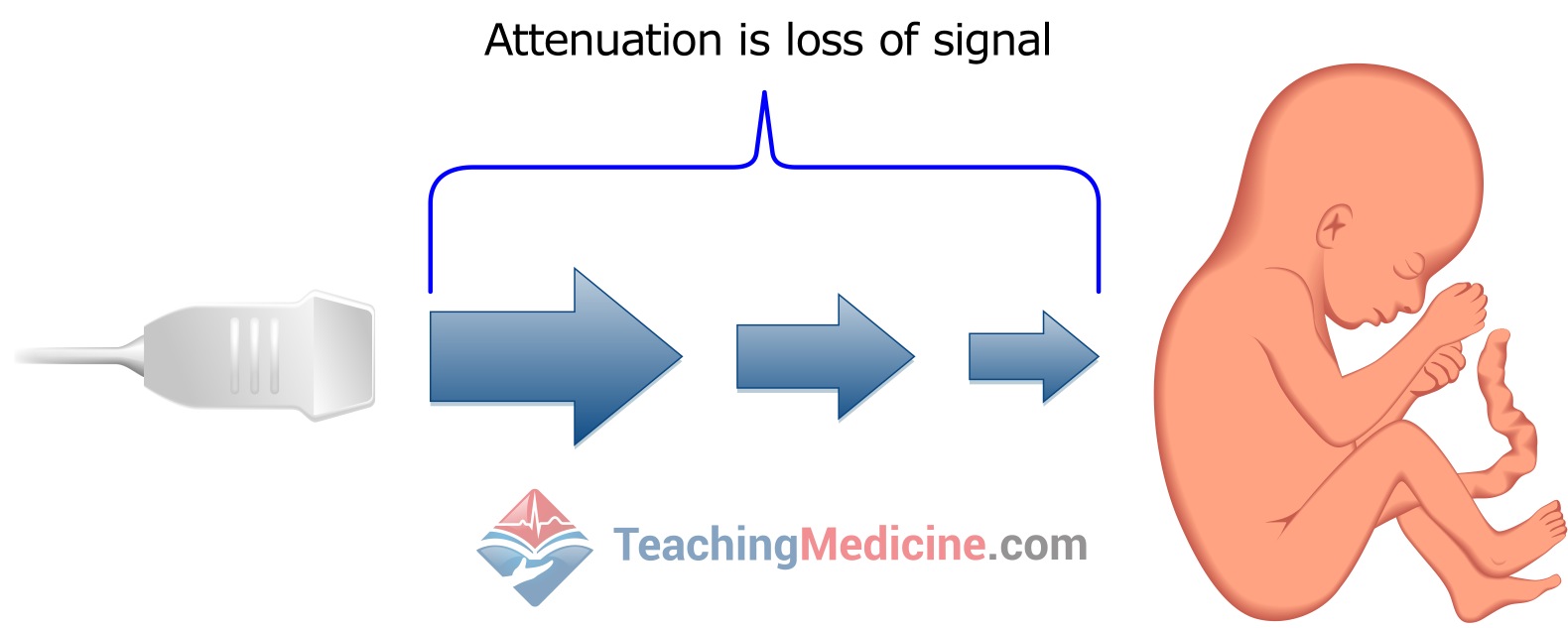 attenuation is loss of signal