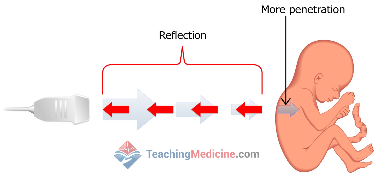 reflection bounces the signal back to the transducer