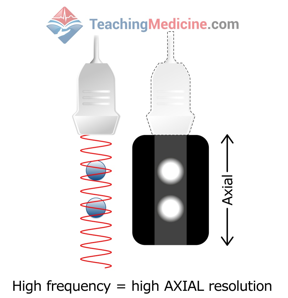 high frequency gives high axial resolution