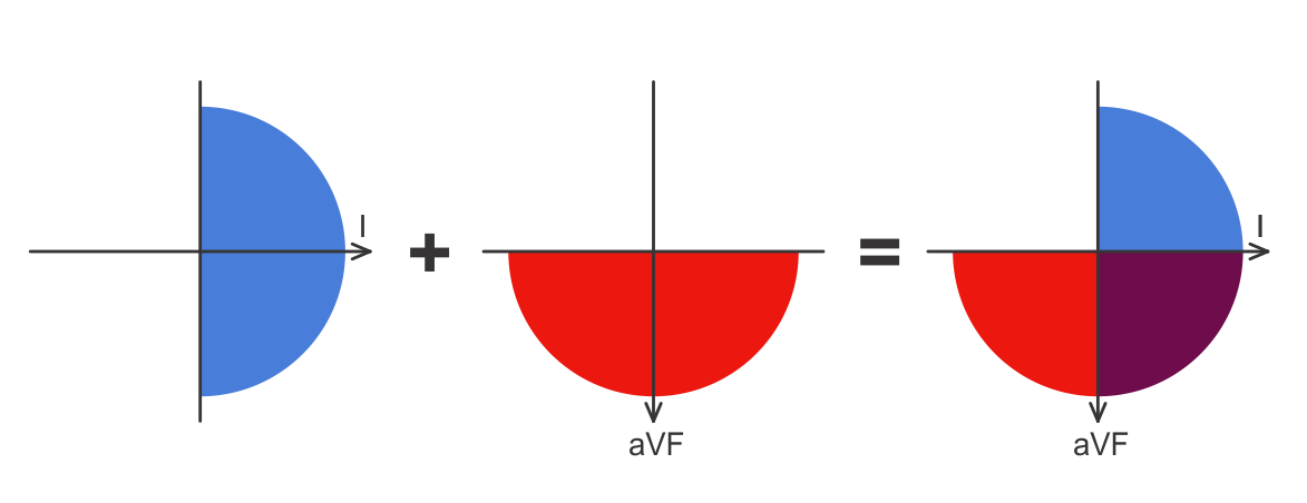 ECG quadrants