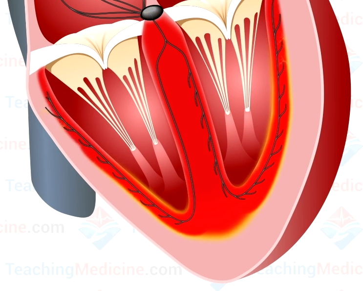 depolarization of the ventricles