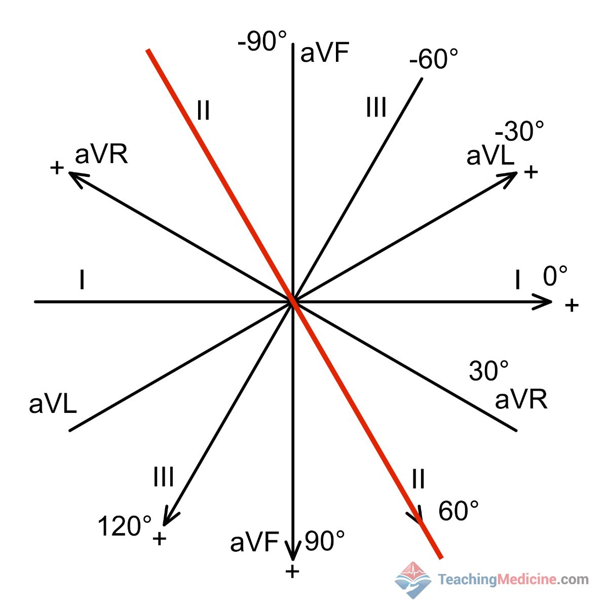 ECG isoelectric lead