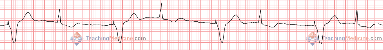 irregular with a pattern