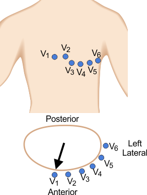 precordial leads