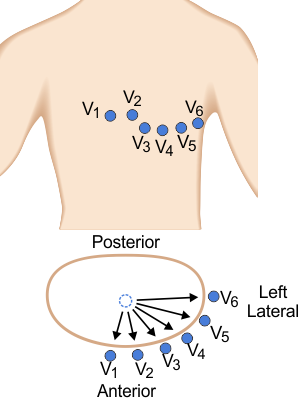 Precordial leads showing the "ground" electrode as the circle with the blue dotted line