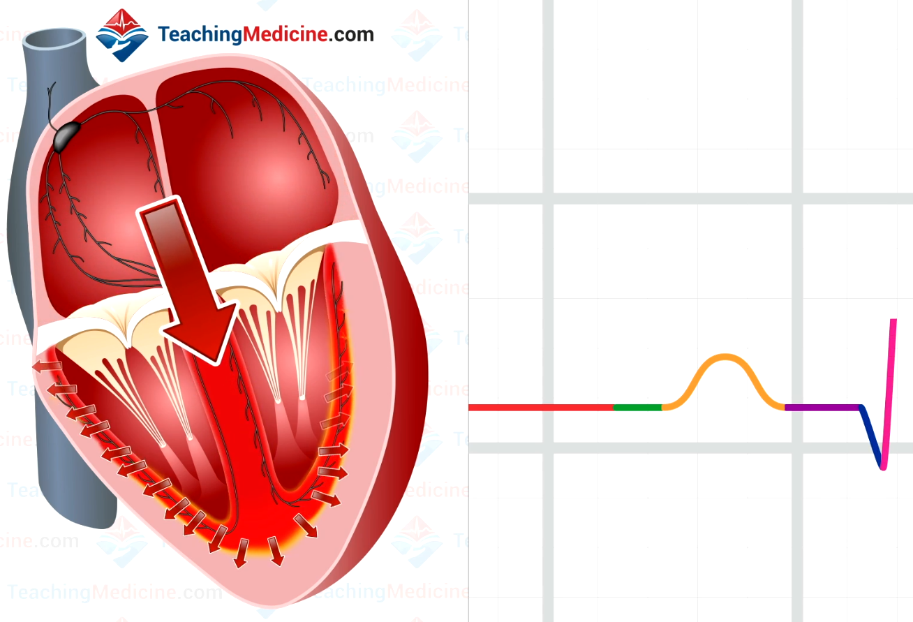 Depolarization from endocardium to epicardium in the ventricle