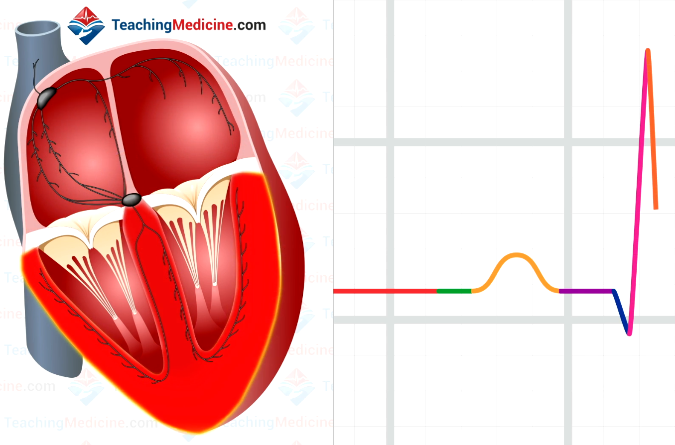 Depolarization is completed so there is no movement of electrical activity and the deflection returns to baseline