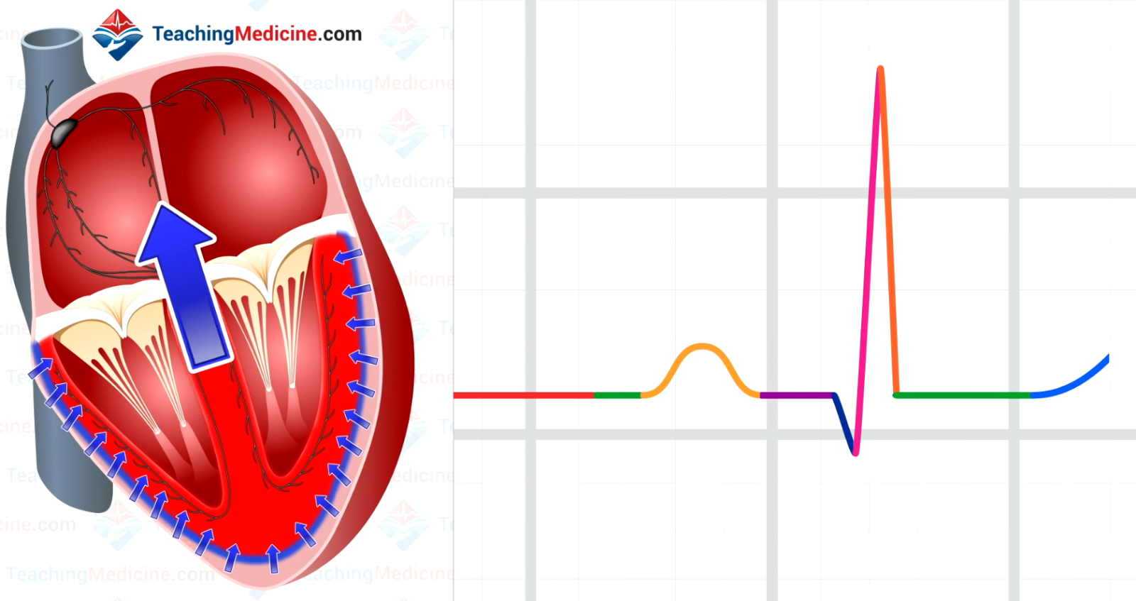 REpolarization now occurs