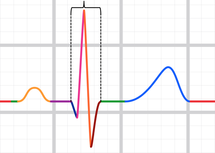 QRS complex