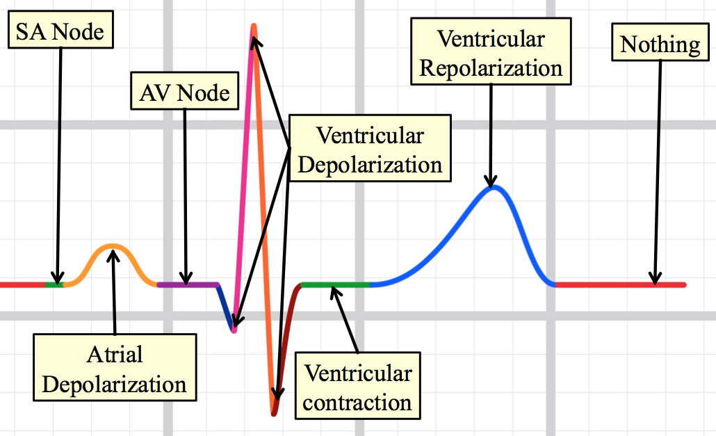 All actions on the ECG