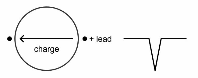 Depolarization travelling away from positive lead gives downward deflection