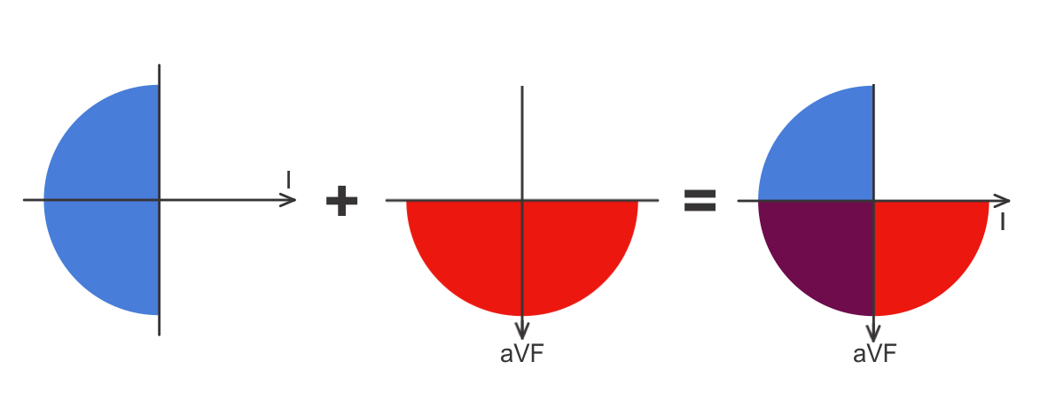 RAD ECG axis