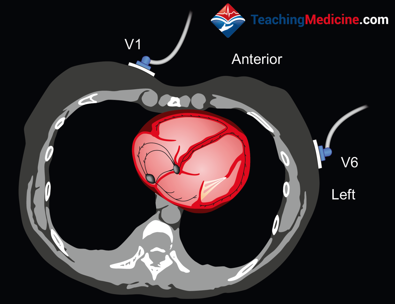 understanding LBBB