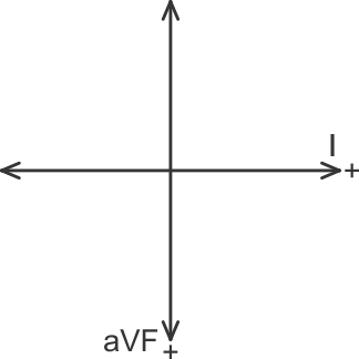 ECG quadrants