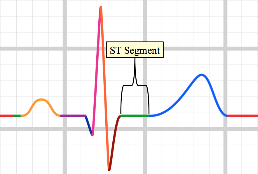 ST segment